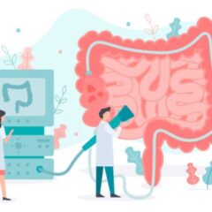 大腸の健康診断🔍